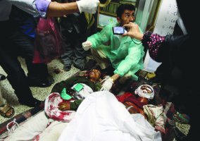 ضحايا من اشتباكات الأمس في صنعاء 