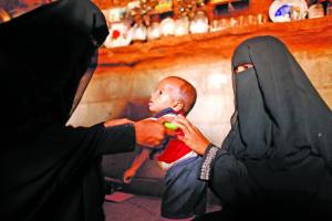 متطوعتان يمنيتان في الحديدة تساعدان طفلاً يعاني سوء تغذية