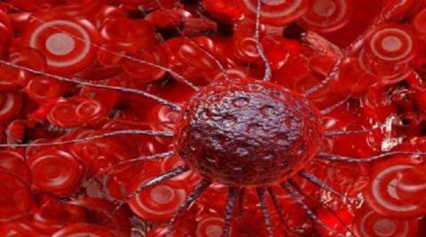  ثوري يحارب سرطان الدم دون آثار جانبية سامة