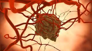 5 طرق تزيد عمر الإنسان كدعم تولد الأوعية بالأطعمة وتجويع الأورام