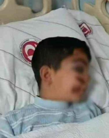  تركي يكسّر عظام طفل سوري لم تعجبه ردوده