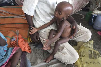 طفل صومالي مصاب بسوء التغذية يجلس على حضن والده في مخيم للاجئين في مقديشو امس (ا ب) 