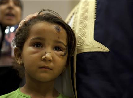 طفلة ليبية اصيبت بغارة اطلسية ادت الى مقتل 85 مدنيا تتحدث الى وسائل الاعلام في طرابلس امس (ا ب) 