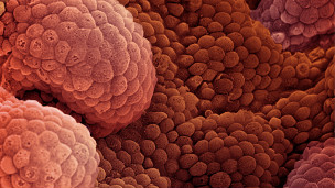 يعمل الفيروس على مهاجمة الخلايا السرطانية في انحاء الجسم